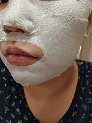 아이디플라코스메틱 페이스핏 플라스터 마스크 — 2.5점을 준 리뷰어가 2020년 5월 올린 사용 사진