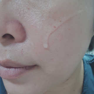닥터마시멜로 닥터 마시멜로 마블러스 히알루론산 앰플 — 5점을 준 리뷰어가 2020년 9월 올린 사용 사진