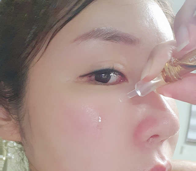 바베 프로테오글리칸 F+F 앰플 솔루션 리뷰 사진