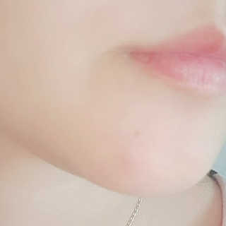 엘라밴드 하이드로 도트 스팟패치 12mm, 10mm — 5점을 준 리뷰어가 2020년 11월 올린 사용 사진