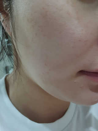 메디필 에스테 더마 유산균 콜라겐 클리어 — 3점을 준 리뷰어가 2020년 5월 올린 사용 사진