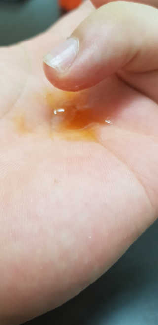 메디페르 [ 2+1 ] 루테인앰플 10ml 2개 + 루테인크림 50ml 1개 — 5점을 준 리뷰어가 2020년 8월 올린 사용 사진