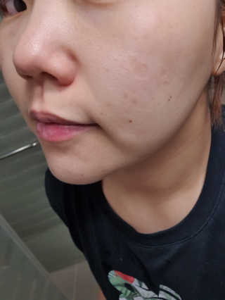 메디필 에스테 더마 유산균 콜라겐 클리어 — 4점을 준 리뷰어가 2020년 5월 올린 사용 사진