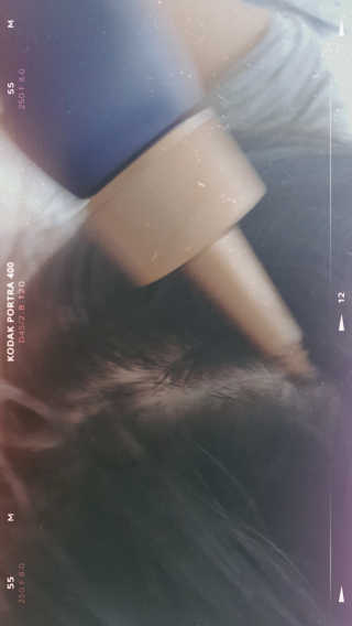 [크리산]  모근.모발강화 악티프 토닉 — 5점을 준 리뷰어가 2020년 6월 올린 사용 사진
