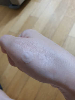 엘라밴드 하이드로 도트 스팟패치 12mm, 티트리 — 5점을 준 리뷰어가 2020년 8월 올린 사용 사진