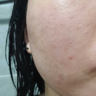 네이처컬렉션 닥터벨머 아미노클리어 아크네 버블 폼 — 4.5점을 준 리뷰어가 2020년 6월 올린 사용 사진