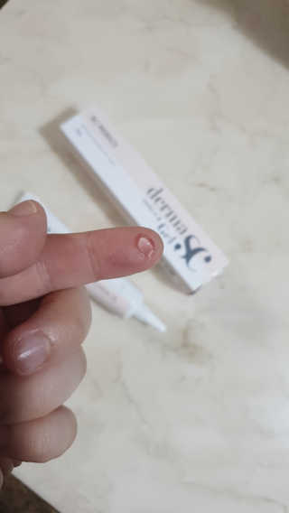 derma SC-Gel 더마에스씨 겔 20g — 5점을 준 리뷰어가 2020년 4월 올린 사용 사진