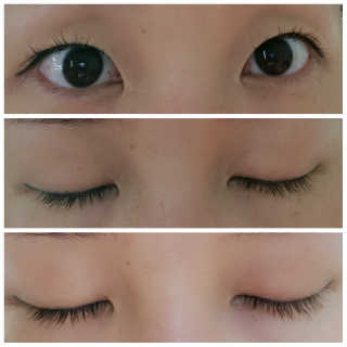 닥터존스킨 눈썹자라 — 5점을 준 리뷰어가 2020년 8월 올린 사용 사진
