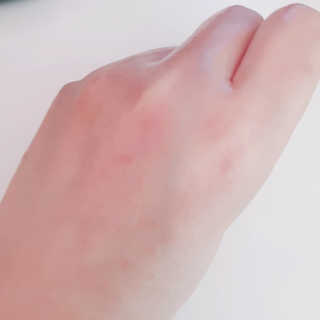 바베 BABE 바베 프로테오글리칸 F+F 앰플 솔루션 — 5점을 준 리뷰어가 2020년 7월 올린 사용 사진
