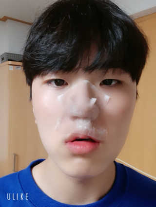 메디필 블랙 허니 세범 익스트렉터 — 리뷰어가 2020년 6월 올린 사용 사진