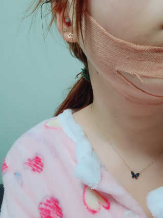 아이디플라코스메틱 아이디 페이스핏 마이너스 밴드 v2 — 5점을 준 리뷰어가 2020년 12월 올린 사용 사진
