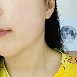 바이오믹 센시메틱 수딩 토너 — 5점을 준 리뷰어가 2020년 7월 올린 사용 사진