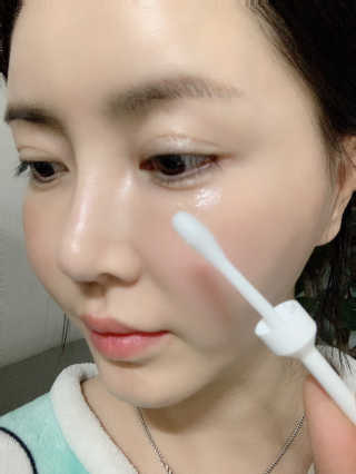 [오지랩] 애교살을 원하는 당신을 위해, 애교봉 — 5점을 준 리뷰어가 2020년 12월 올린 사용 사진