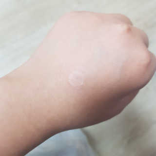 엘라밴드 하이드로 도트 스팟패치 12mm, 10mm — 5점을 준 리뷰어가 2020년 8월 올린 사용 사진