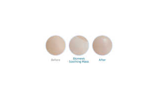 바이오믹 BIOMEEK SENSIMETIC SOOTHING MASK.S — 5점을 준 리뷰어가 2020년 7월 올린 사용 사진