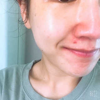 [스킨큐어] 산다화 비타민C 화이트닝 에센스 30ml — 4.5점을 준 리뷰어가 2020년 4월 올린 사용 사진