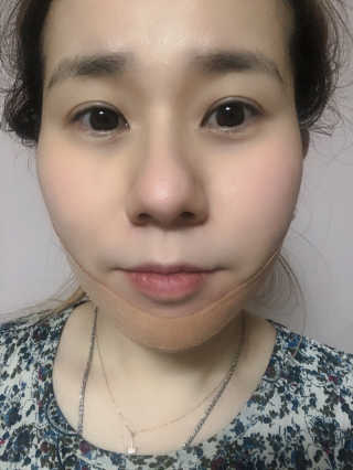 아이디플라코스메틱 아이디 페이스핏 마이너스 밴드 v2 — 5점을 준 리뷰어가 2020년 12월 올린 사용 사진