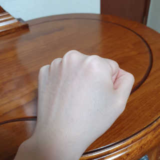 엘라밴드 하이드로 도트 스팟패치 12mm, 티트리 — 4.5점을 준 리뷰어가 2020년 8월 올린 사용 사진