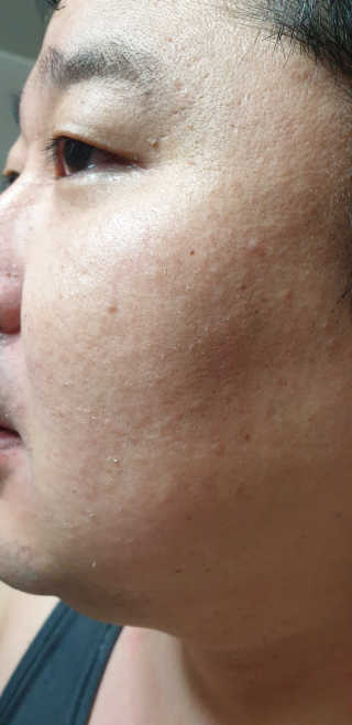 메디필 에스테 더마 유산균 콜라겐 클리어 — 4점을 준 리뷰어가 2020년 5월 올린 사용 사진