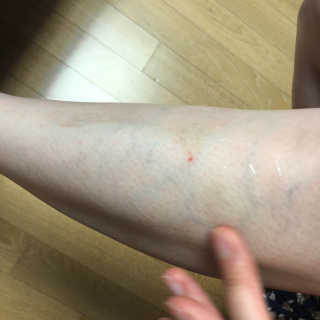 바이애콤 퓨어 카밍 수딩 젤 크림 — 5점을 준 리뷰어가 2020년 6월 올린 사용 사진
