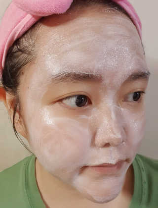 메디필 에스테 더마 유산균 콜라겐 클리어 — 5점을 준 리뷰어가 2020년 5월 올린 사용 사진