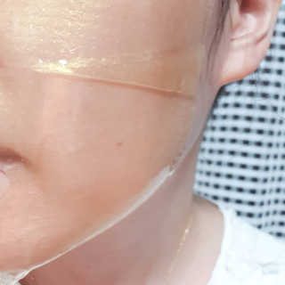 한미려 프리미엄 하이드로겔 마스크 — 5점을 준 리뷰어가 2020년 7월 올린 사용 사진