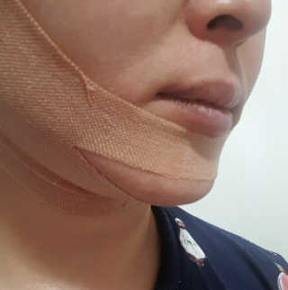 아이디플라코스메틱 아이디 페이스핏 마이너스 밴드 v2 — 5점을 준 리뷰어가 2020년 12월 올린 사용 사진