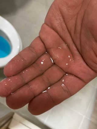 달리프 진저 베러 퍼퓸 탈모 완화 샴푸 1000ml 향 3종 — 5점을 준 리뷰어가 2020년 11월 올린 사용 사진