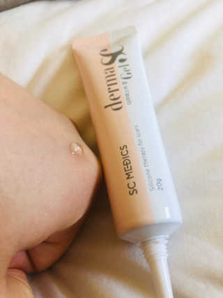 derma SC-Gel 더마에스씨 겔 20g — 5점을 준 리뷰어가 2020년 4월 올린 사용 사진