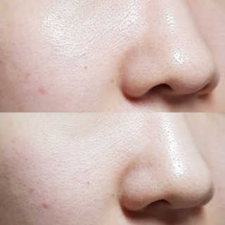 [후르디아] 피지 많은 피부엔- 청포도 스크럽 클렌징폼 — 5점을 준 리뷰어가 2020년 6월 올린 사용 사진
