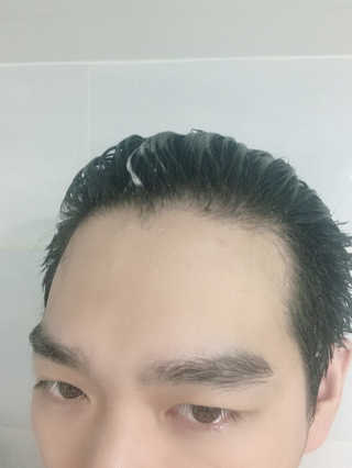 [두피헤어 트리트먼트] 케이원큐어 스켈프 젤 270ml — 3점을 준 리뷰어가 2020년 9월 올린 사용 사진