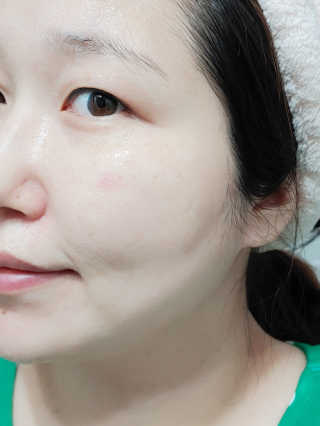 메디힐 캘러스 멀티 골드 리프팅 크림 — 5점을 준 리뷰어가 2020년 9월 올린 사용 사진