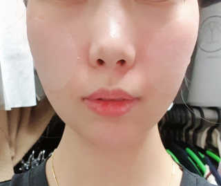 자이엘 S.O.S 레드 칙 케어팩 2 Box — 5점을 준 리뷰어가 2020년 4월 올린 사용 사진
