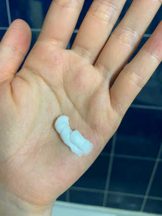 메디필 에스테 더마 유산균 콜라겐 클리어 — 5점을 준 리뷰어가 2020년 5월 올린 사용 사진