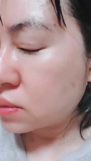 SPF50 PA++++ 선크림까지 완벽하게, 비페스타 2종 — 5점을 준 리뷰어가 2020년 5월 올린 사용 사진