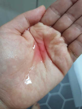 어글리프루프 에센스 스탑디어글리 레드모먼트 에센스 120ml — 5점을 준 리뷰어가 2020년 8월 올린 사용 사진