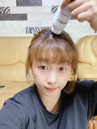 라보에이치 탈모증상완화 토닉 두피쿨링 — 5점을 준 리뷰어가 2020년 9월 올린 사용 사진