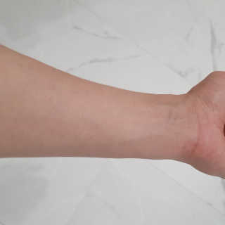 엘라밴드 하이드로 도트 스팟패치 12mm, 10mm — 5점을 준 리뷰어가 2020년 8월 올린 사용 사진