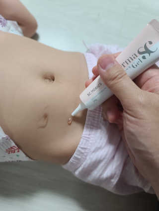 derma SC-Gel 더마에스씨 겔 20g — 5점을 준 리뷰어가 2020년 5월 올린 사용 사진
