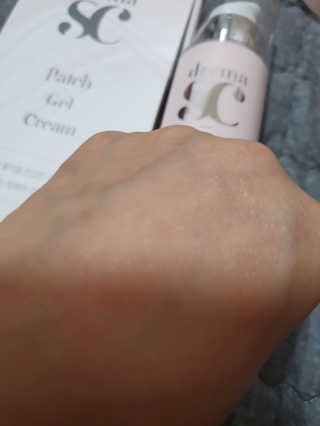 derma SC-Cream 더마에스씨 크림 100ml — 5점을 준 리뷰어가 2020년 4월 올린 사용 사진