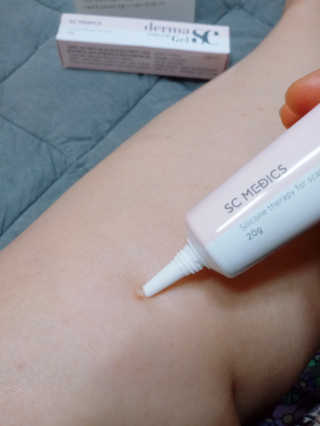 derma SC-Gel 더마에스씨 겔 20g — 5점을 준 리뷰어가 2020년 5월 올린 사용 사진
