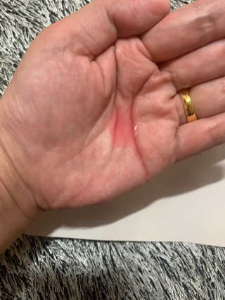 어글리프루프 에센스 스탑디어글리 레드모먼트 에센스 120ml — 5점을 준 리뷰어가 2020년 10월 올린 사용 사진