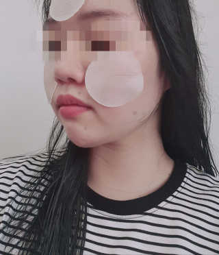 메디힐 티트리 카밍 에센스 패드 — 5점을 준 리뷰어가 2020년 8월 올린 사용 사진