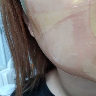 한미려 프리미엄 하이드로겔 마스크 — 5점을 준 리뷰어가 2020년 7월 올린 사용 사진