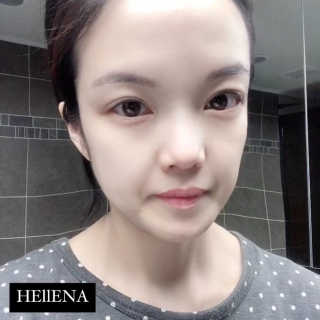 더말로지카 슈퍼 리치 리페어 — 5점을 준 리뷰어가 2020년 10월 올린 사용 사진