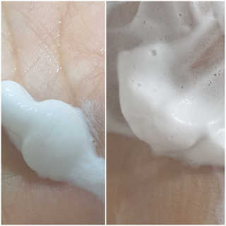 메디필 에스테 더마 유산균 콜라겐 클리어 — 5점을 준 리뷰어가 2020년 5월 올린 사용 사진