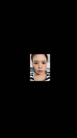 한천수 펩타이드 마스크팩 5종 10매 구성 — 4점을 준 리뷰어가 2020년 6월 올린 사용 사진