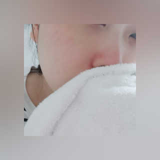 메디필 에스테 더마 유산균 콜라겐 클리어 — 5점을 준 리뷰어가 2020년 7월 올린 사용 사진
