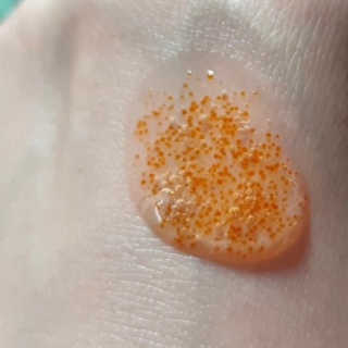 메디페르 [ 1+1 ] 루테인앰플세트 1개 + 루테인크림 50ml 1개 — 5점을 준 리뷰어가 2020년 9월 올린 사용 사진