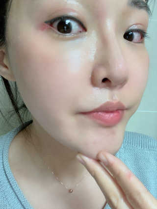 [모메이] 22밸런스 리페어 토너 — 5점을 준 리뷰어가 2020년 4월 올린 사용 사진